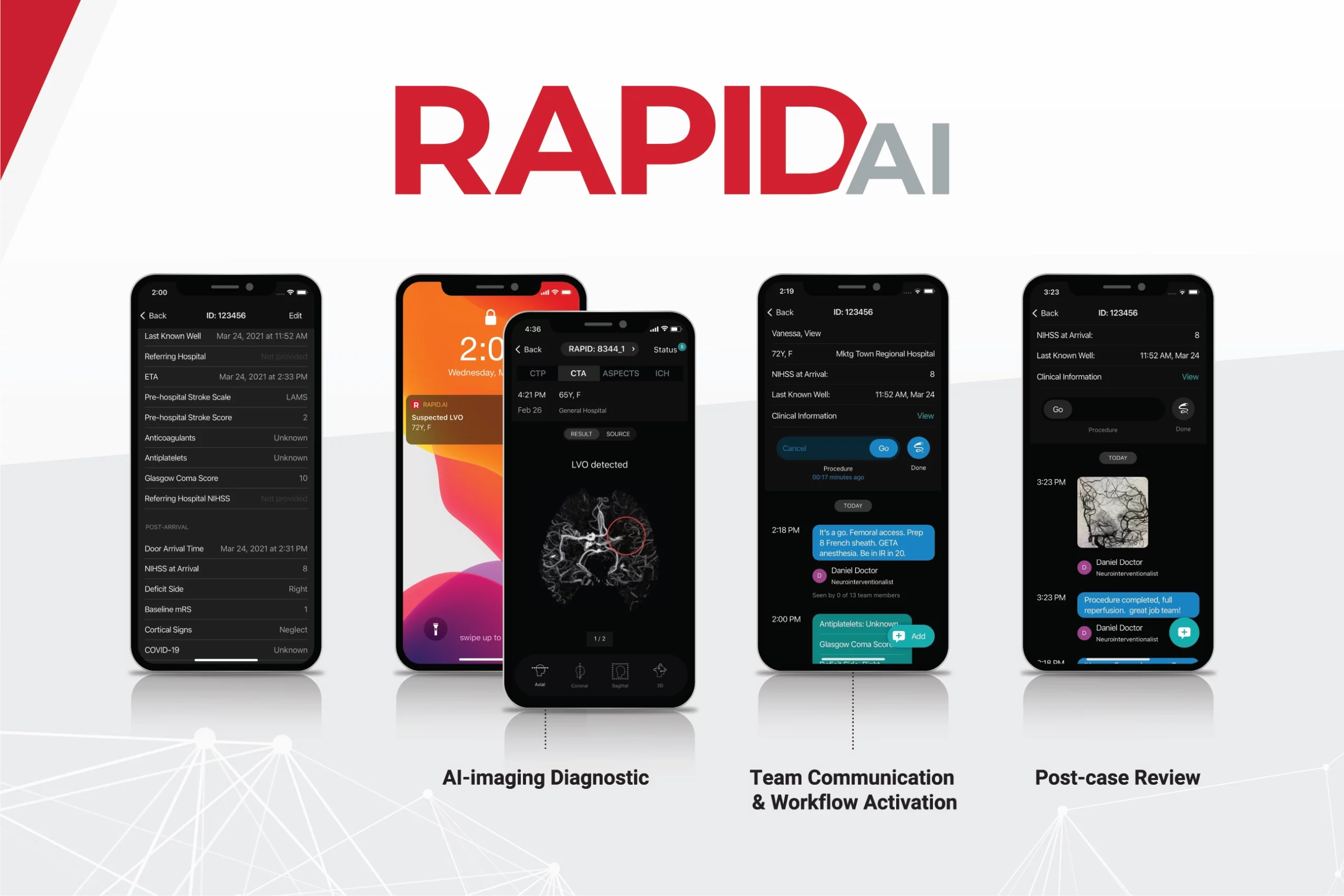 Activa - specializzazione - rapidai